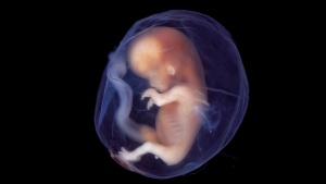A baby fetus.