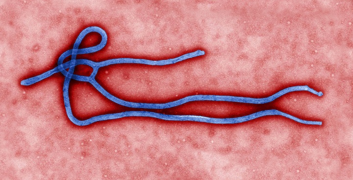 Magnified Ebola virus